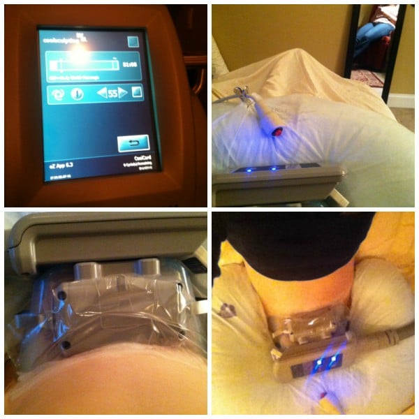 Does Coolsculpting Work? FULL Before & After (With Pictures) MomDot